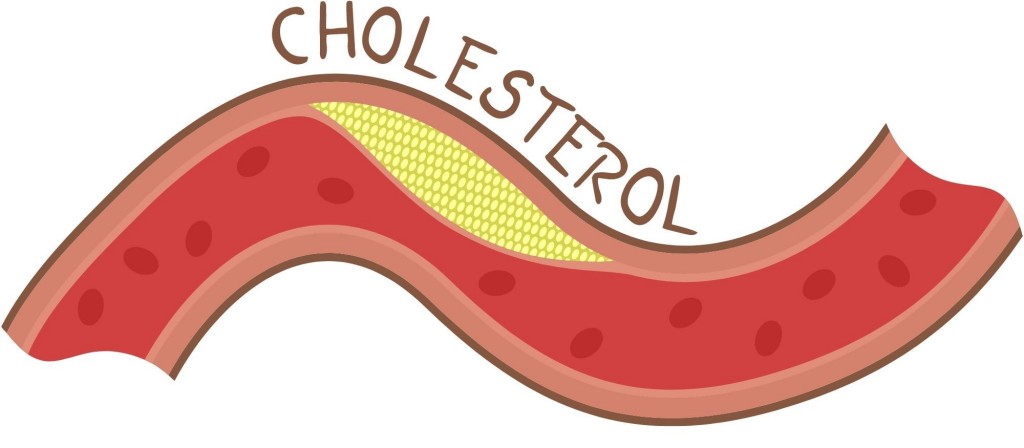 Como bajar el colesterol malo sin medicación 