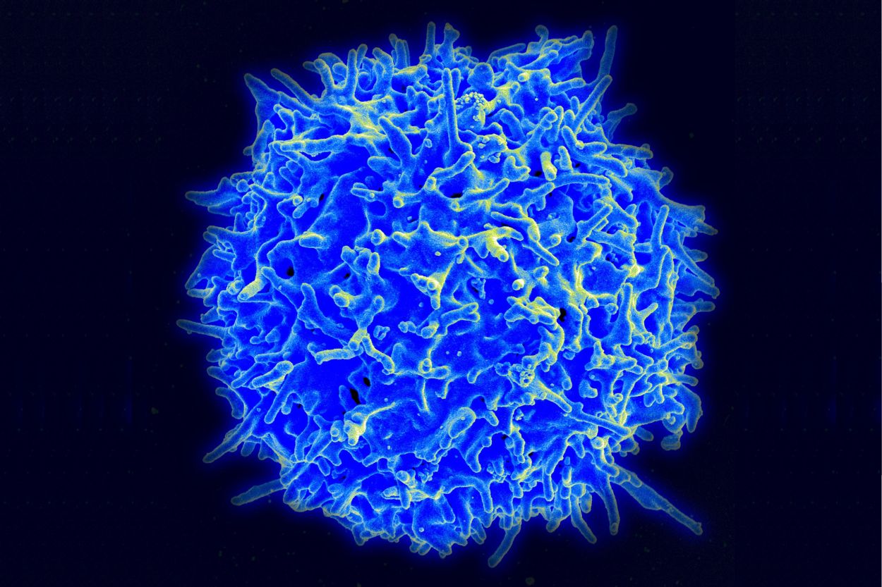 Micrografía electrónica de barrido de un linfocito T humano (también llamado célula T) del sistema inmunitario de un donante sano.