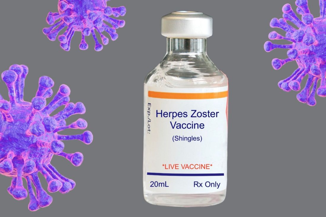 Qué es el herpes zóster